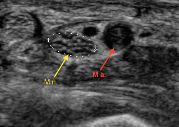 https://cdn.ncbi.nlm.nih.gov/pmc/blobs/bf0d/5024968/995e27a2da24/AJUM-18-82-g001.jpg