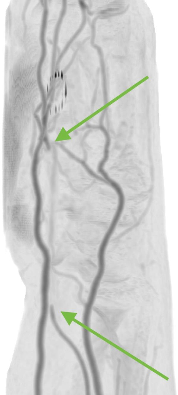 https://cdn.ncbi.nlm.nih.gov/pmc/blobs/bf0d/5024968/a63326c1bfd7/AJUM-18-82-g005.jpg