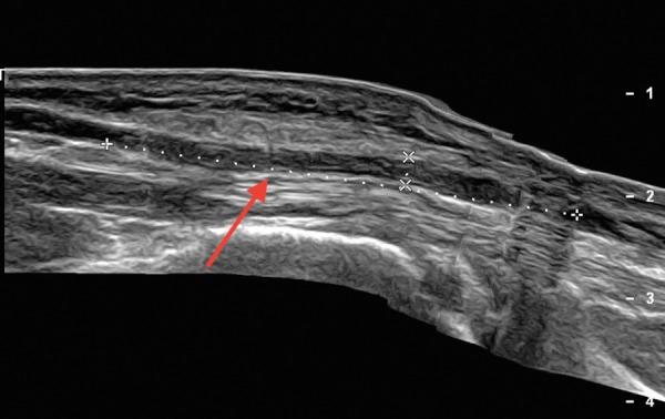 https://cdn.ncbi.nlm.nih.gov/pmc/blobs/bf0d/5024968/aba71c3c7126/AJUM-18-82-g003.jpg