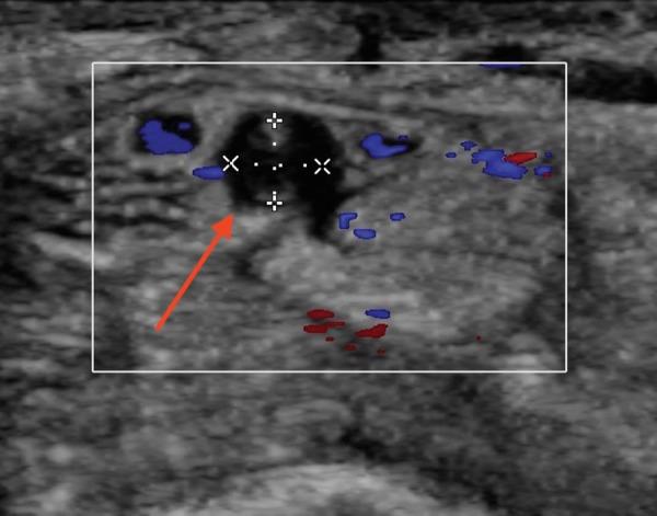 https://cdn.ncbi.nlm.nih.gov/pmc/blobs/bf0d/5024968/d04de1091f33/AJUM-18-82-g002.jpg
