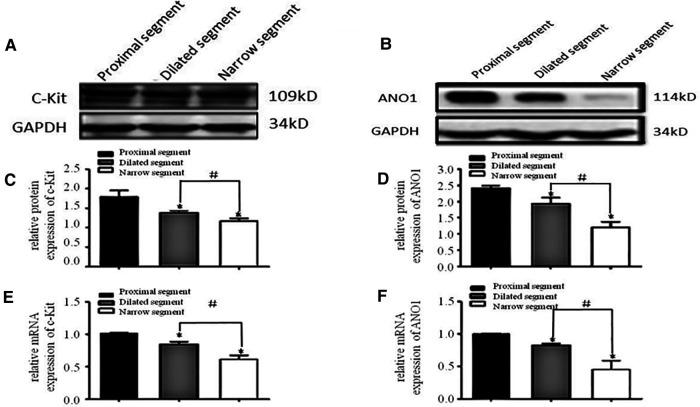 https://cdn.ncbi.nlm.nih.gov/pmc/blobs/bf11/9869412/bf96a77698e0/fped-10-975799-g001.jpg