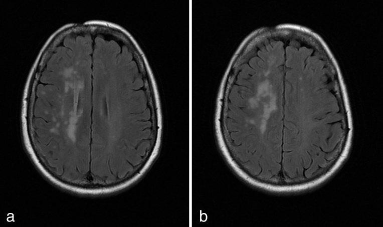 https://cdn.ncbi.nlm.nih.gov/pmc/blobs/bf14/6243297/21f6705dd88b/bjrcr.20150203.g002.jpg