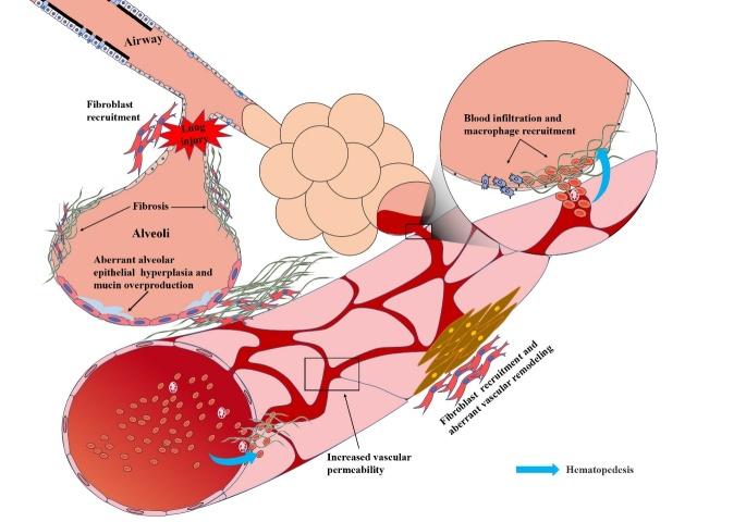 https://cdn.ncbi.nlm.nih.gov/pmc/blobs/bf17/8782547/11a48ae656ca/ad-13-1-73-g2.jpg