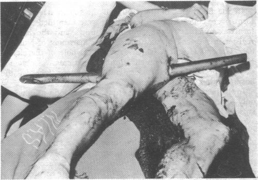 https://cdn.ncbi.nlm.nih.gov/pmc/blobs/bf19/1672351/d77f28783c99/brmedj01433-0047-a.jpg