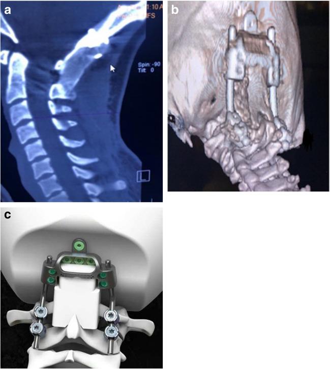 https://cdn.ncbi.nlm.nih.gov/pmc/blobs/bf1a/10758368/91ddcb9e639b/10143_2023_2249_Fig3_HTML.jpg