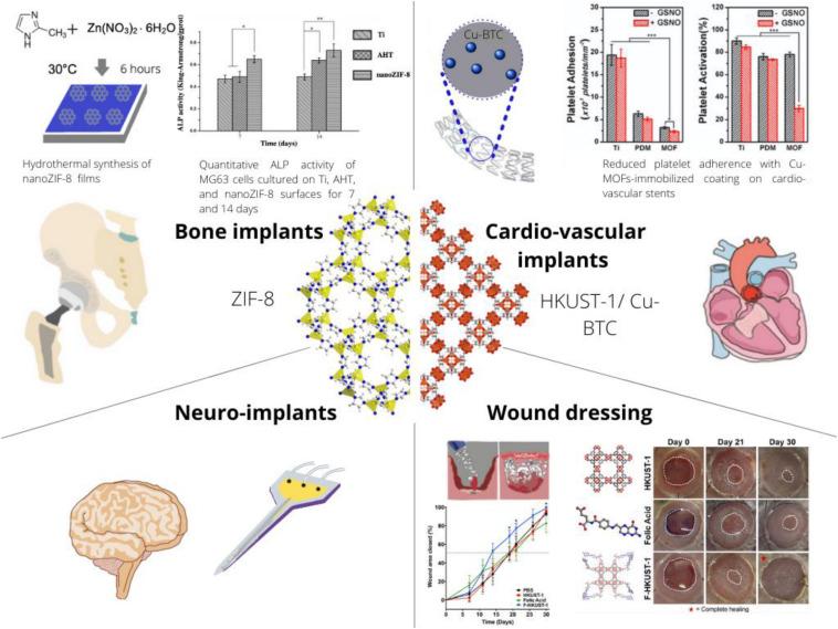 https://cdn.ncbi.nlm.nih.gov/pmc/blobs/bf1b/7991400/87faaa422697/fbioe-09-603608-g001.jpg