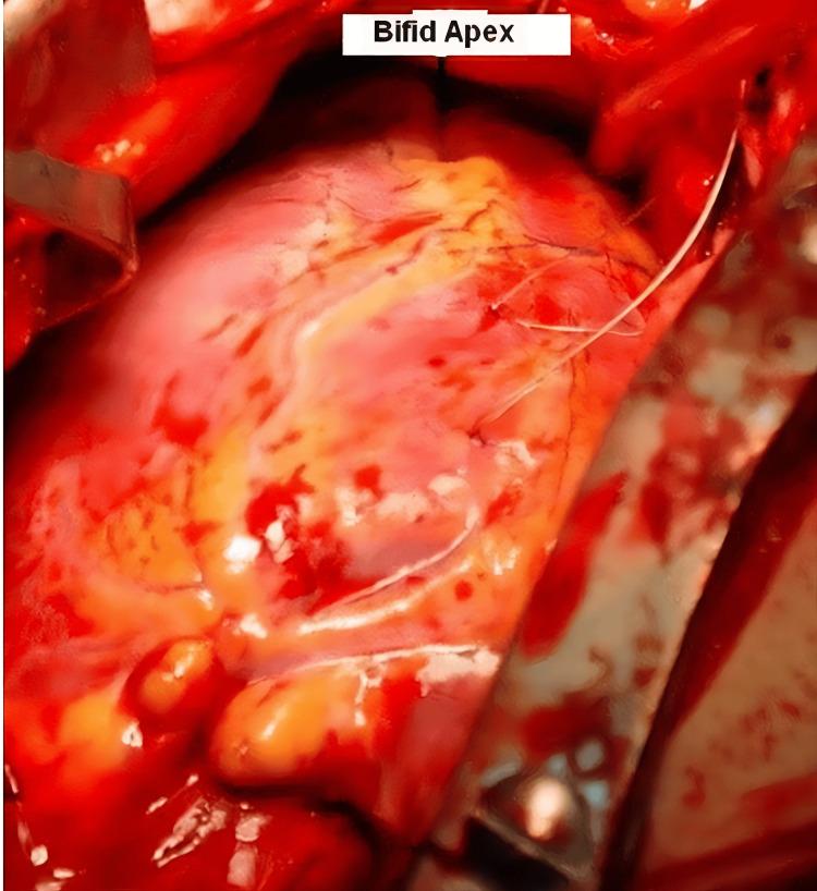 https://cdn.ncbi.nlm.nih.gov/pmc/blobs/bf22/12066023/076b2d9b724a/cureus-0017-00000082066-i02.jpg