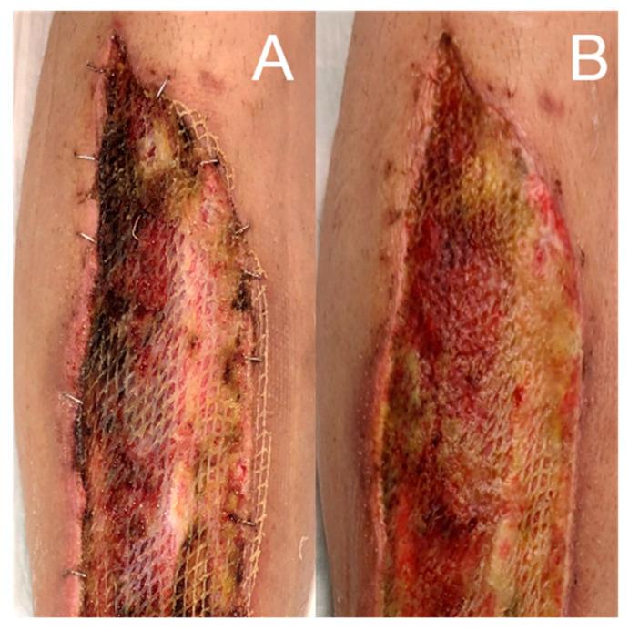 https://cdn.ncbi.nlm.nih.gov/pmc/blobs/bf23/10532083/851fcf843997/jcm-12-06001-g004.jpg