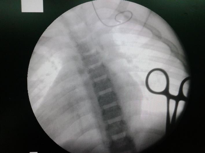 https://cdn.ncbi.nlm.nih.gov/pmc/blobs/bf2b/8077304/bab714b3a51e/CCR3-9-1977-g005.jpg