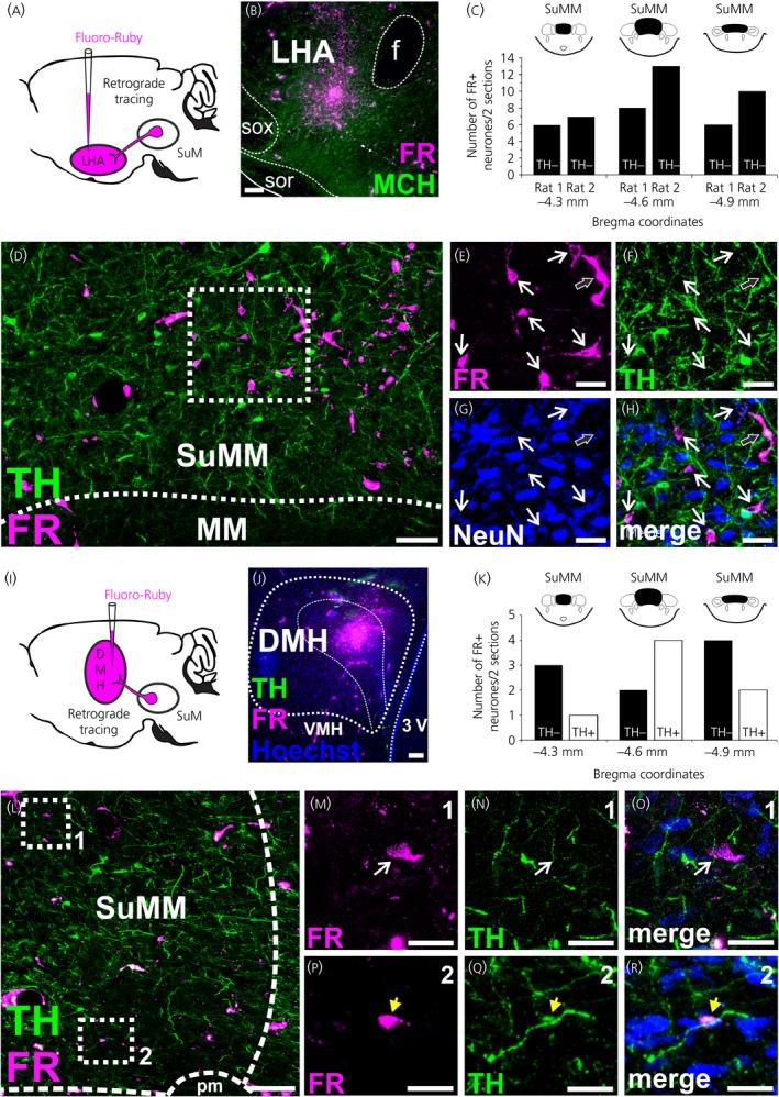 https://cdn.ncbi.nlm.nih.gov/pmc/blobs/bf37/7065010/69b1be9c88dd/JNE-32-e12829-g003.jpg