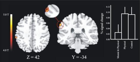 https://cdn.ncbi.nlm.nih.gov/pmc/blobs/bf3a/2577943/00635ee4fe4b/TONIJ-2-5_F4.jpg