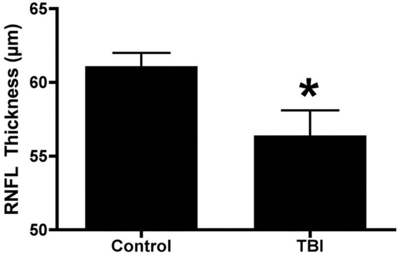 https://cdn.ncbi.nlm.nih.gov/pmc/blobs/bf3b/9888755/c80d293cdfbe/oppen3-3161352.jpg