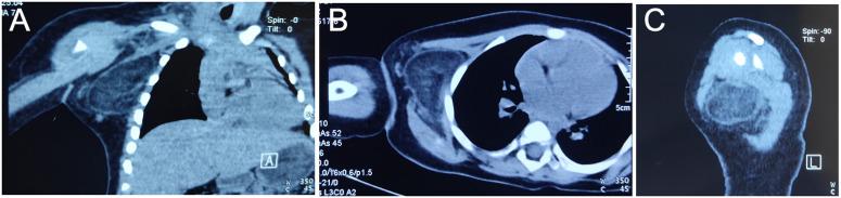 https://cdn.ncbi.nlm.nih.gov/pmc/blobs/bf3c/11663630/c8e3f287134a/fped-12-1485832-g002.jpg
