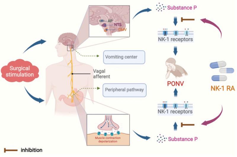 https://cdn.ncbi.nlm.nih.gov/pmc/blobs/bf3e/10662847/f4ae111b55a8/medi-102-e34385-g004.jpg