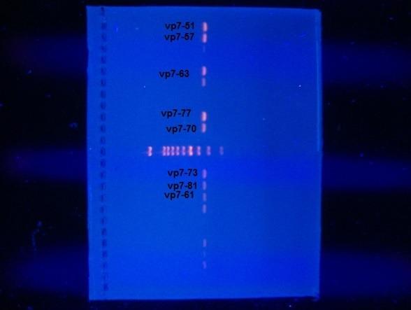 https://cdn.ncbi.nlm.nih.gov/pmc/blobs/bf3e/5724952/6f3a6ed49615/PAMJ-28-87-g001.jpg