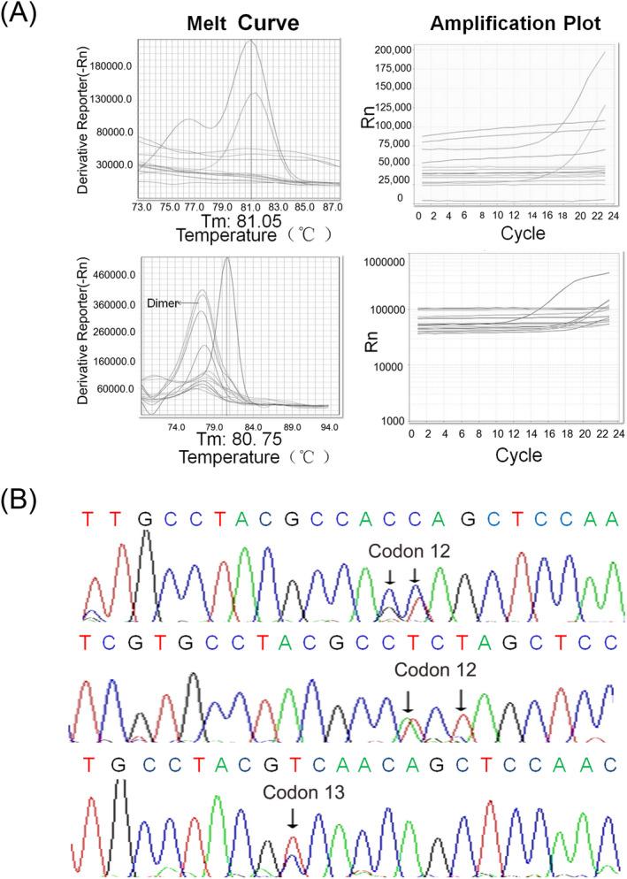 https://cdn.ncbi.nlm.nih.gov/pmc/blobs/bf48/7439329/9113703bb35b/JCLA-34-e23305-g004.jpg