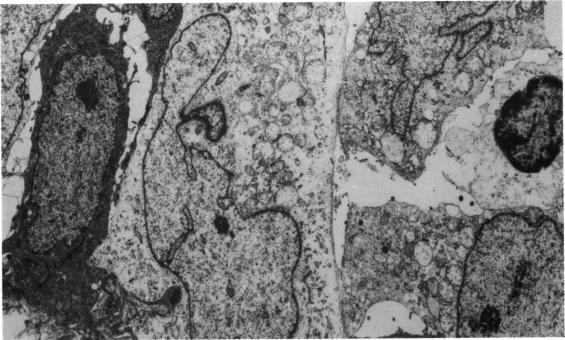 https://cdn.ncbi.nlm.nih.gov/pmc/blobs/bf55/1040859/cb9a53f8161f/brjopthal00132-0033-a.jpg
