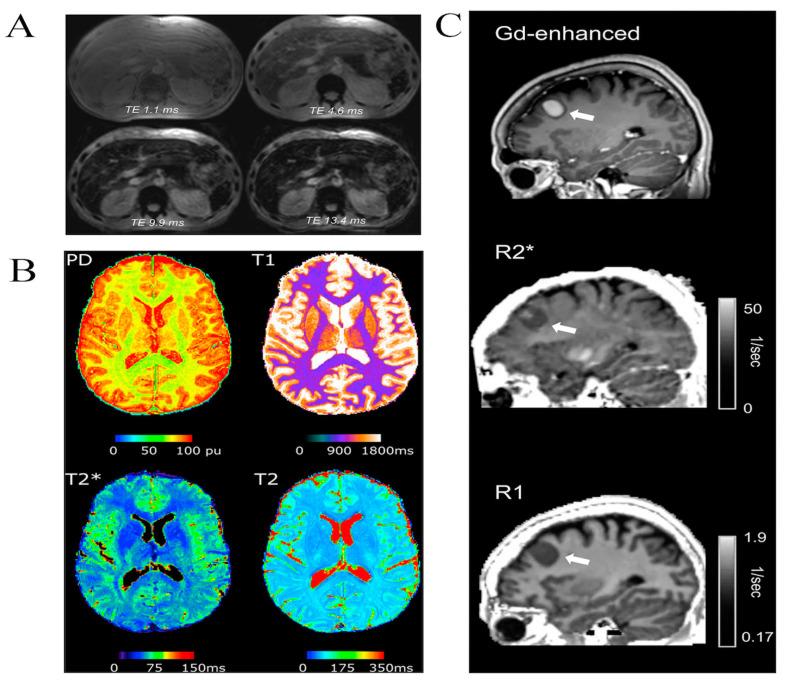 https://cdn.ncbi.nlm.nih.gov/pmc/blobs/bf5a/11049567/c004e90eba85/cimb-46-00175-g002.jpg