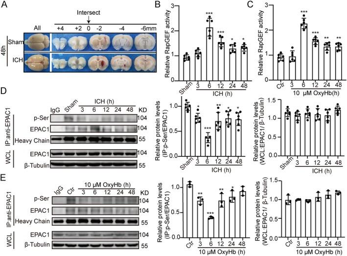 https://cdn.ncbi.nlm.nih.gov/pmc/blobs/bf5b/11979711/cd31b0c52d94/CNS-31-e70373-g003.jpg