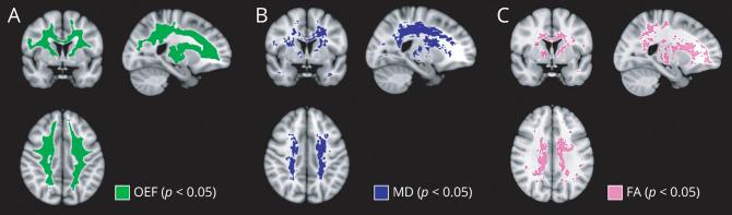 https://cdn.ncbi.nlm.nih.gov/pmc/blobs/bf5b/8408504/8165e32c7f56/NEUROLOGY2021170604F2.jpg