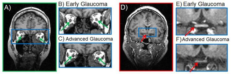 https://cdn.ncbi.nlm.nih.gov/pmc/blobs/bf5b/8945790/7d80f2c36c77/biology-11-00454-g002.jpg