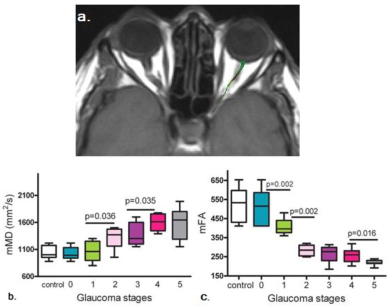 https://cdn.ncbi.nlm.nih.gov/pmc/blobs/bf5b/8945790/80a4c85eb9cf/biology-11-00454-g006.jpg