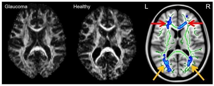 https://cdn.ncbi.nlm.nih.gov/pmc/blobs/bf5b/8945790/fda89ed7ae66/biology-11-00454-g007.jpg