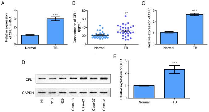 https://cdn.ncbi.nlm.nih.gov/pmc/blobs/bf61/8855514/5c957731f0de/etm-23-04-11178-g02.jpg