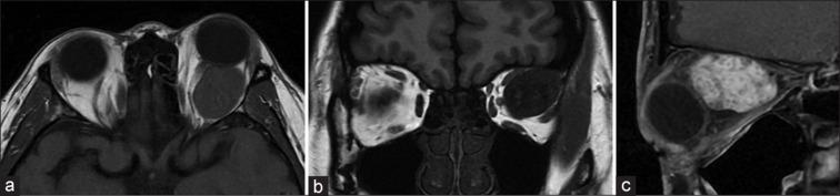 https://cdn.ncbi.nlm.nih.gov/pmc/blobs/bf63/11670842/5d724906245c/IJO-72-919-g001.jpg