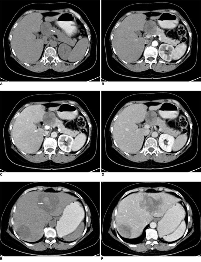 https://cdn.ncbi.nlm.nih.gov/pmc/blobs/bf69/2893319/a211c68c5557/kjr-11-472-g001.jpg
