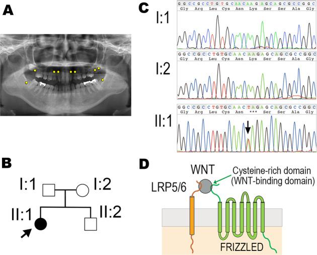https://cdn.ncbi.nlm.nih.gov/pmc/blobs/bf6c/9879990/5431c2b3a755/41439_2023_230_Fig1_HTML.jpg
