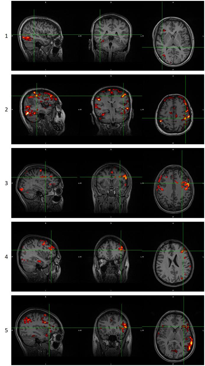 https://cdn.ncbi.nlm.nih.gov/pmc/blobs/bf6e/10468574/42f10bc88b70/fpsyt-14-1214067-g0002.jpg