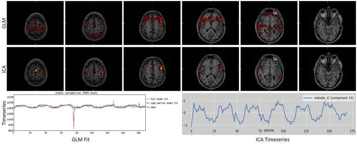 https://cdn.ncbi.nlm.nih.gov/pmc/blobs/bf6e/10468574/6431fa5a09da/fpsyt-14-1214067-g0005.jpg