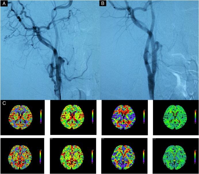 https://cdn.ncbi.nlm.nih.gov/pmc/blobs/bf71/5435210/4d85eccedcb1/svn-2016-000024f03.jpg