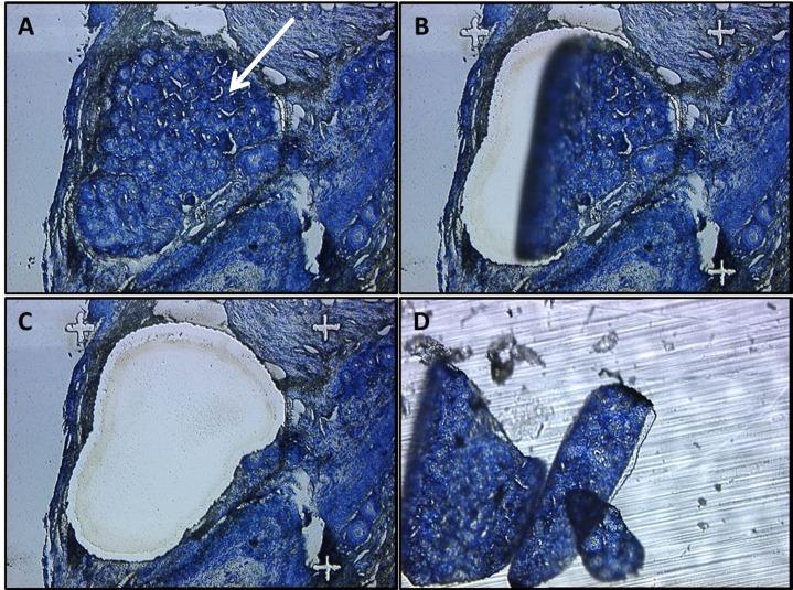 https://cdn.ncbi.nlm.nih.gov/pmc/blobs/bf78/4732786/14052875b28c/pone.0148018.g001.jpg