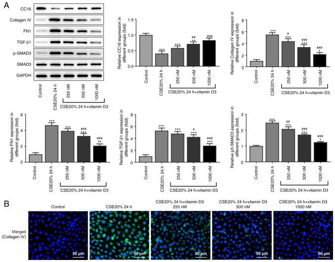 https://cdn.ncbi.nlm.nih.gov/pmc/blobs/bf7a/9019742/79aafebcc0f9/etm-23-05-11284-g03.jpg