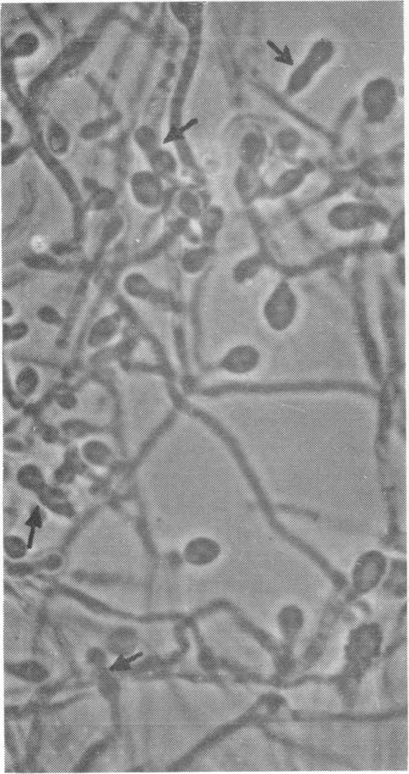 https://cdn.ncbi.nlm.nih.gov/pmc/blobs/bf7d/314801/08550f31ffe7/jbacter00594-0172-b.jpg