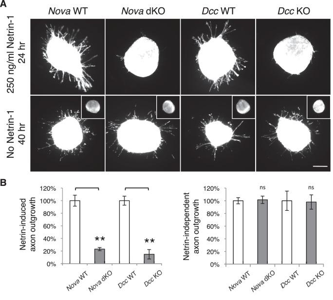 https://cdn.ncbi.nlm.nih.gov/pmc/blobs/bf85/4930329/00308125a63f/elife-14264-fig5.jpg