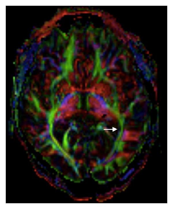 https://cdn.ncbi.nlm.nih.gov/pmc/blobs/bf89/4140146/2f36e3c8a9c3/CRINM2014-102307.002.jpg