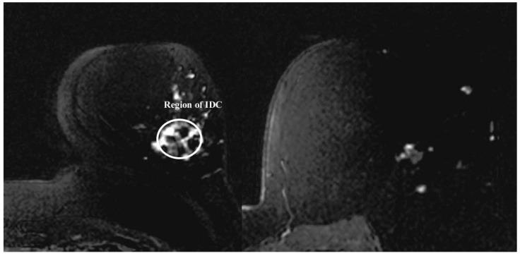 https://cdn.ncbi.nlm.nih.gov/pmc/blobs/bf8b/6022049/9cac9c00aa8b/sensors-18-01678-g006.jpg