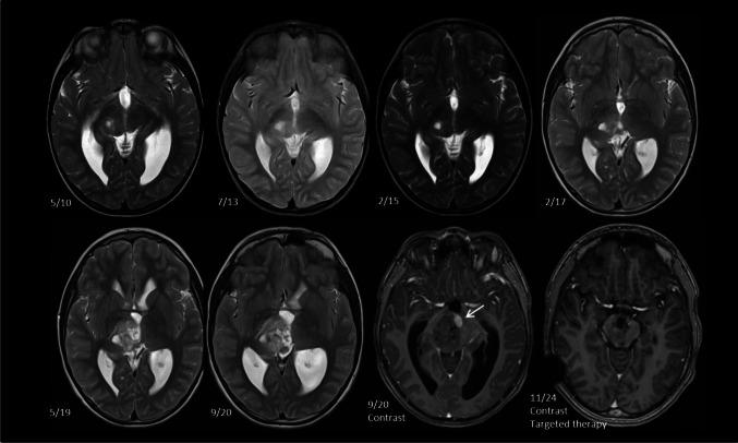 https://cdn.ncbi.nlm.nih.gov/pmc/blobs/bf8d/12334495/ed17b24bca08/701_2025_6632_Fig2_HTML.jpg