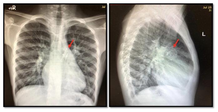 https://cdn.ncbi.nlm.nih.gov/pmc/blobs/bf8f/10069705/09dfa5ba1c4b/sha50-54f1.jpg