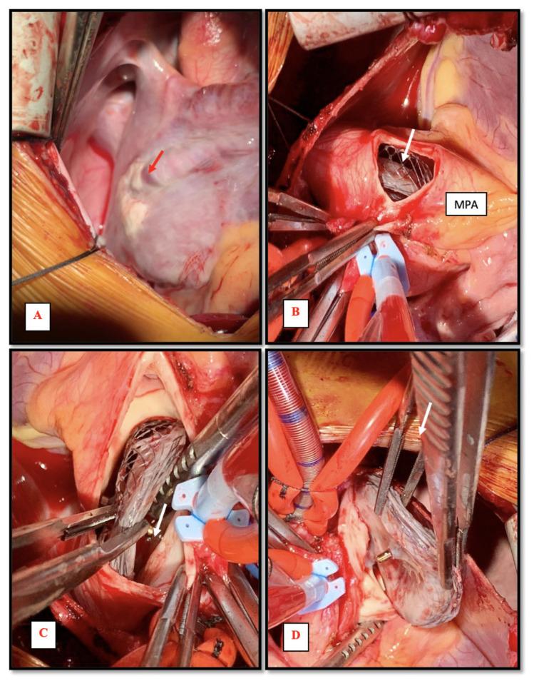 https://cdn.ncbi.nlm.nih.gov/pmc/blobs/bf8f/10069705/cc065bd1cc9b/sha50-54f5.jpg