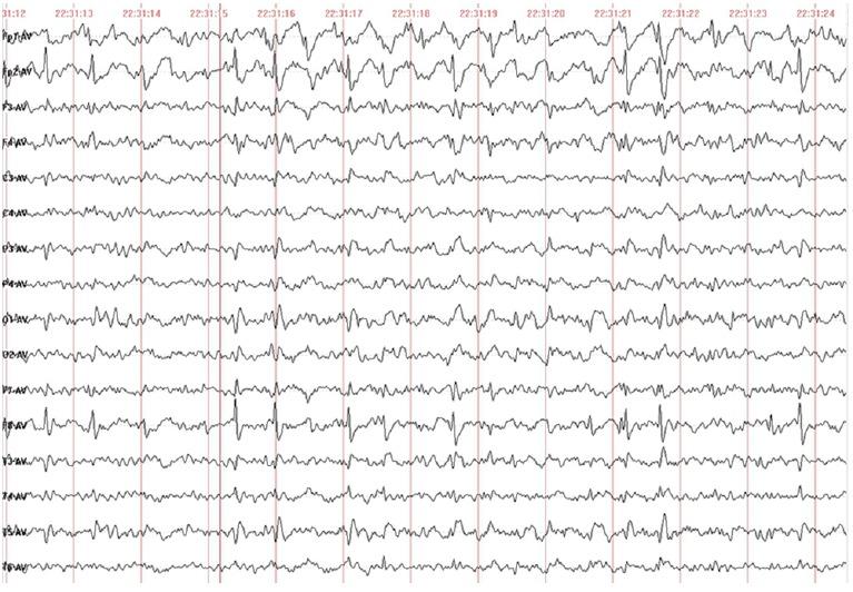 https://cdn.ncbi.nlm.nih.gov/pmc/blobs/bf94/6212609/6ed04a64d6f1/WJCC-6-570-g001.jpg