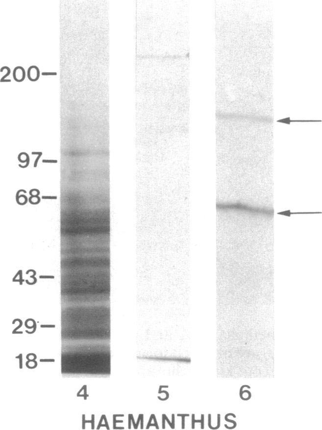 https://cdn.ncbi.nlm.nih.gov/pmc/blobs/bf96/53949/dadcbd863a69/pnas01034-0356-b.jpg