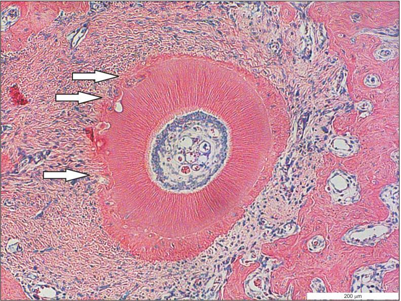https://cdn.ncbi.nlm.nih.gov/pmc/blobs/bf96/8607123/77ee52d2334a/kjod-51-6-366-f5.jpg