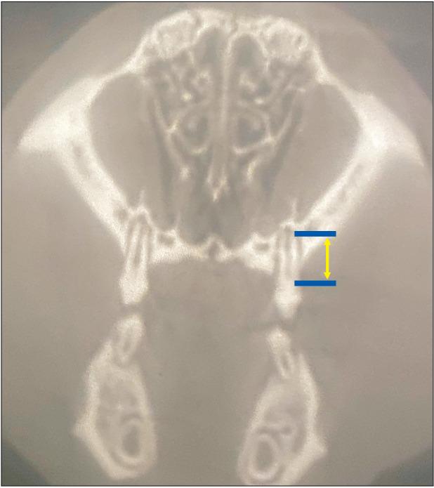 https://cdn.ncbi.nlm.nih.gov/pmc/blobs/bf96/8607123/e5db372240ca/kjod-51-6-366-f4.jpg