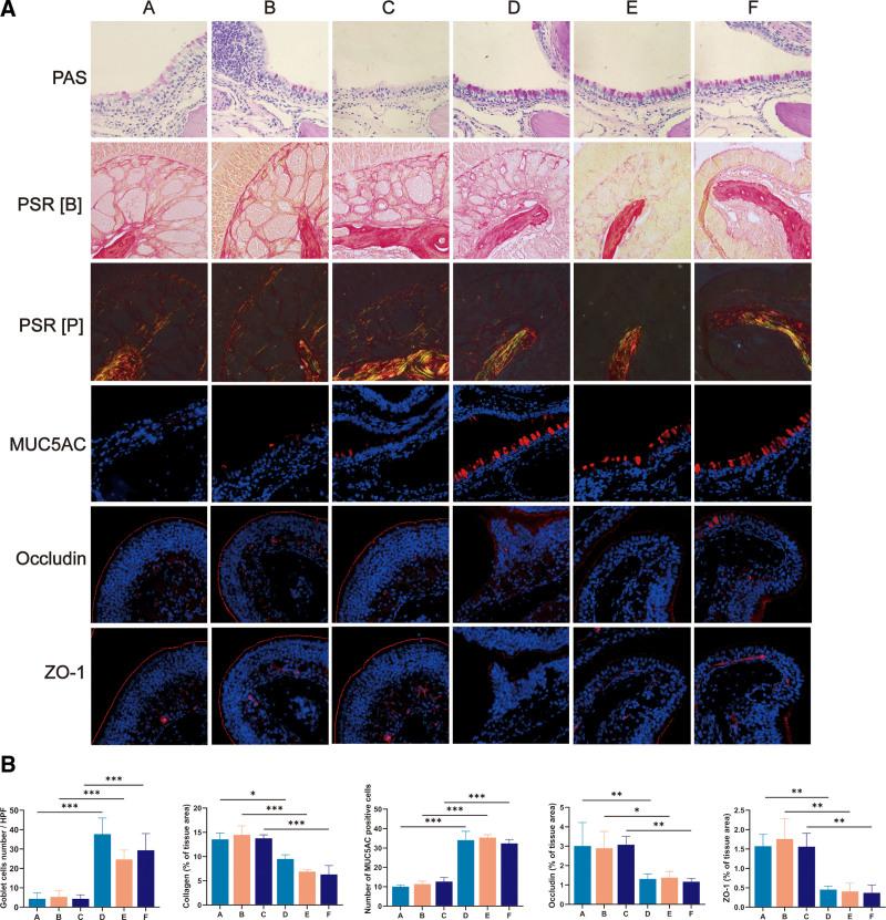 https://cdn.ncbi.nlm.nih.gov/pmc/blobs/bfa7/10715747/037531d58e6a/pa9-13-164-g005.jpg
