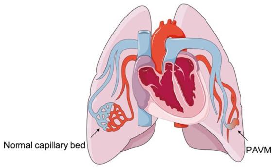 https://cdn.ncbi.nlm.nih.gov/pmc/blobs/bfb0/11446853/c9f14d03cd4b/fmed-11-1449496-g001.jpg
