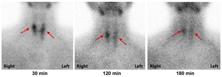 https://cdn.ncbi.nlm.nih.gov/pmc/blobs/bfb2/9600646/9809b5e82977/diagnostics-12-02553-g002.jpg